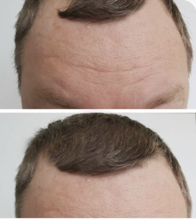 Before and after 2.png