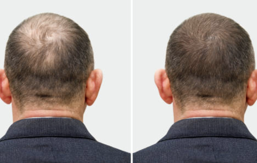 Before and after 5.png