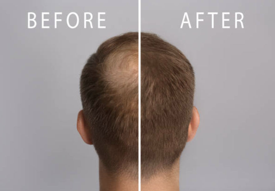 Before and after 4.png