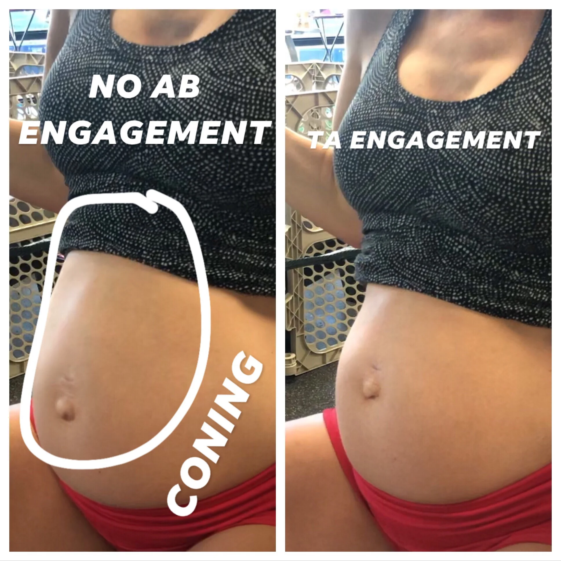 Can You Prevent Diastasis Or Abdominal Separation During Pregnancy Mamastefit