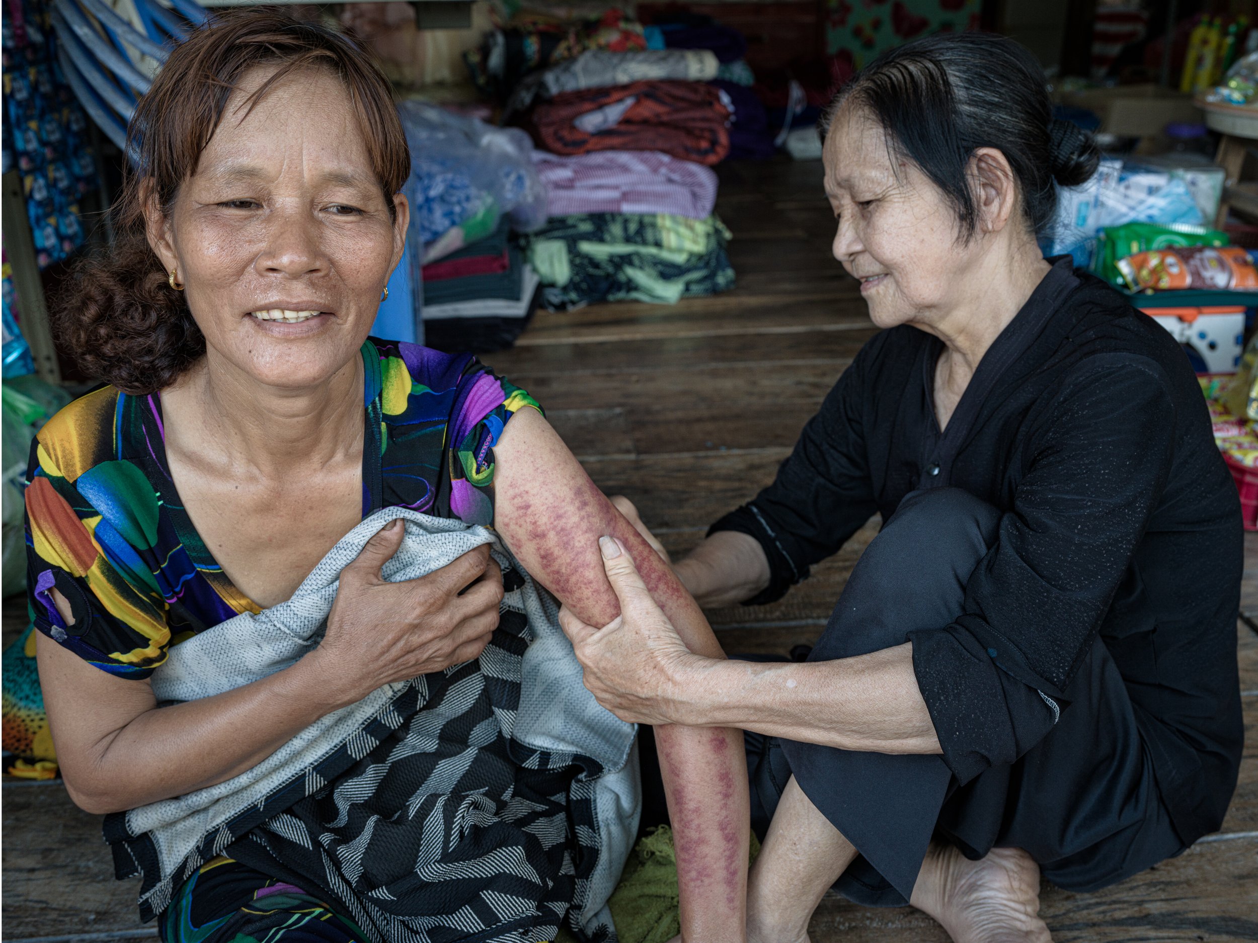 healing the effects of a bad wind