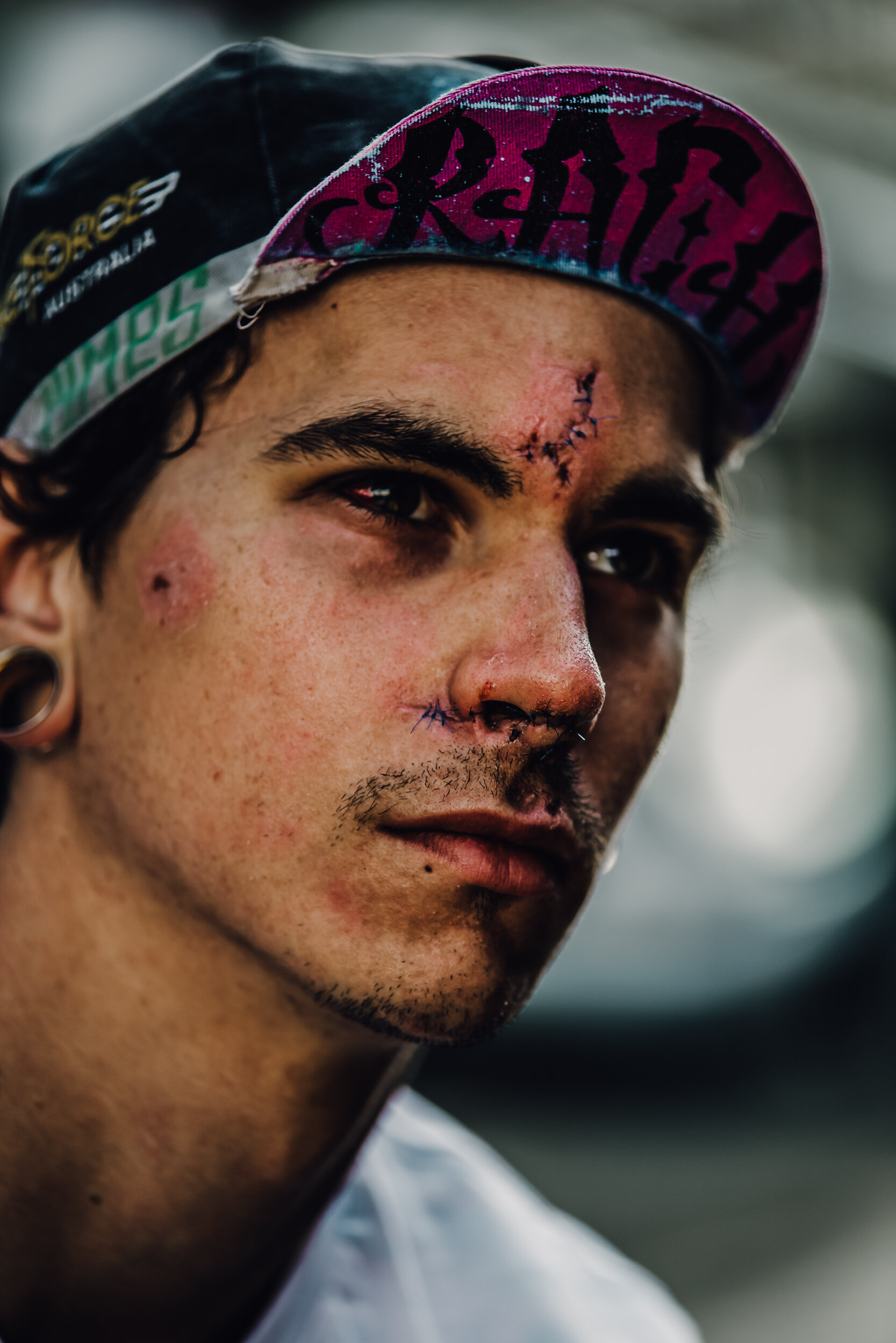 accident-injury-rider-portrait-bike-sunset