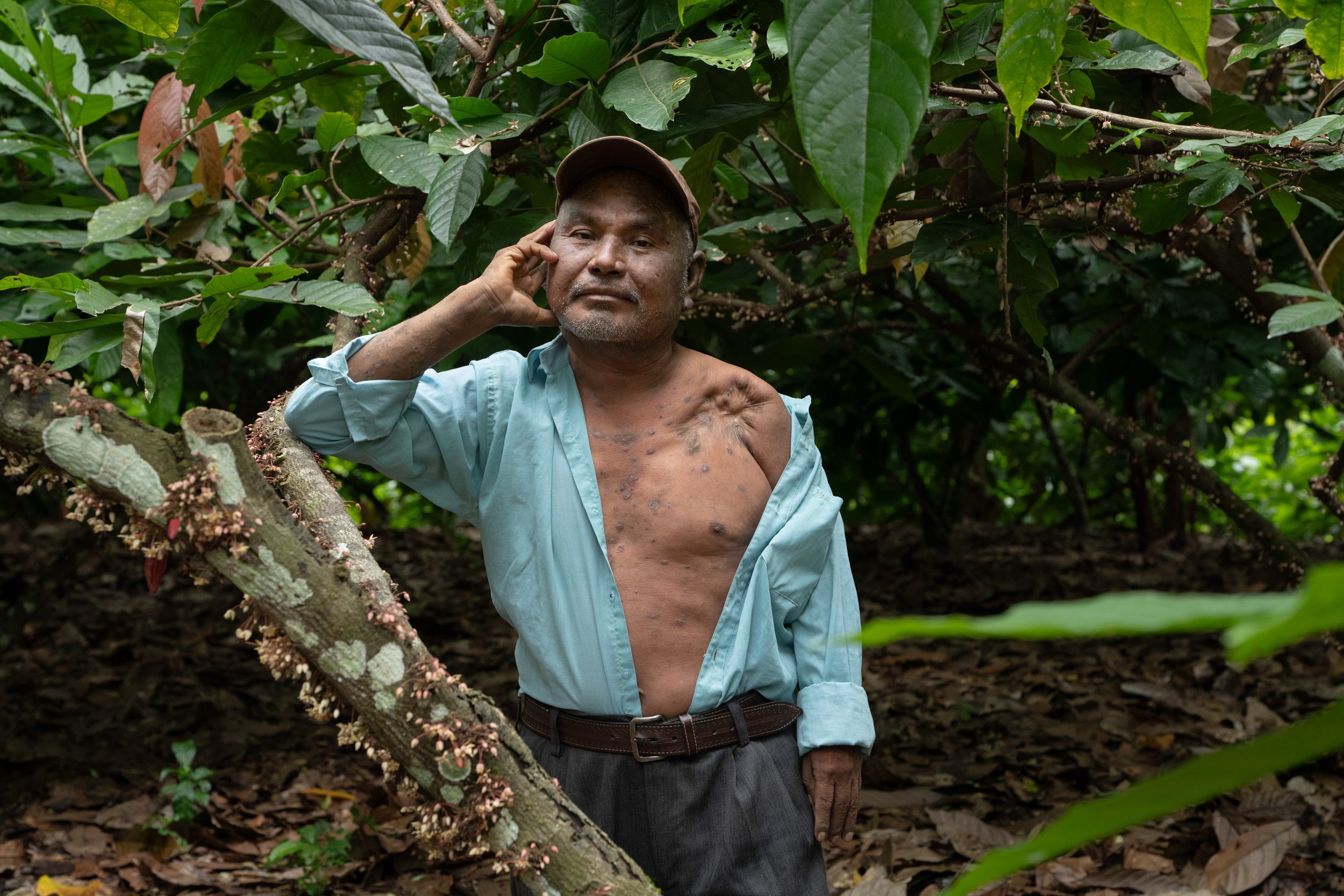 During the Guatemalan Civil War, Pinares, a Mayan village in the Alta Verapaz region, suffered many losses. Among the 100 families who lived there, over thirty people died and many were injured. When he was eleven years old, Rimiro Tec was shot in th