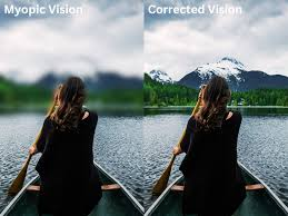What is Refractive Error and Why Does it Affect Your Vision?