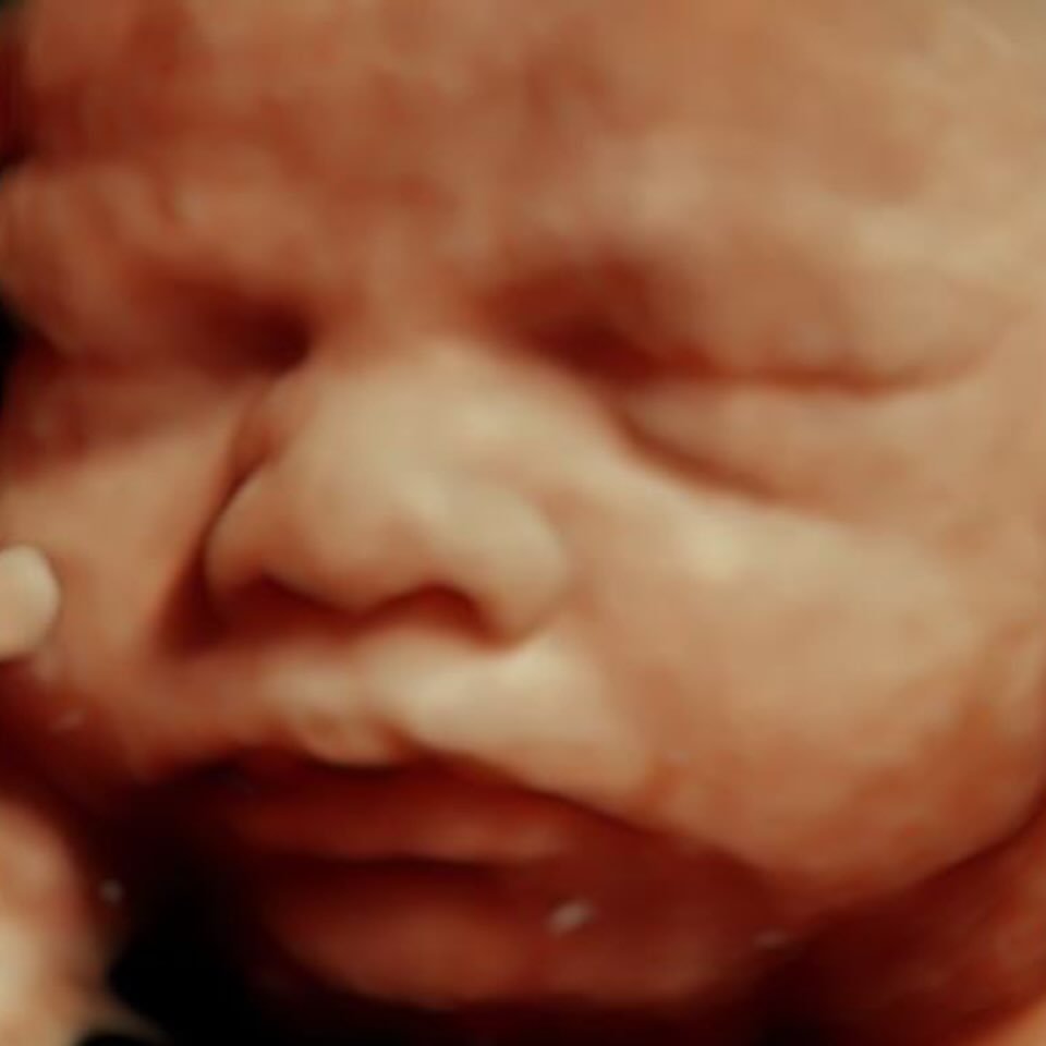 ✨ Let&rsquo;s get technical ✨

At Close to Baby, we combine clinical expertise with advanced ultrasound technology to deliver a truly exceptional imaging experience.

Every scan is performed by registered diagnostic medical sonographer who is board c