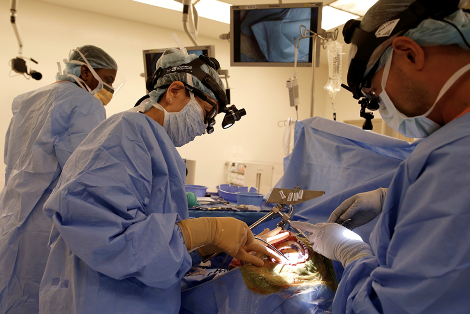 New U of M research suggests race may factor into brain tumor care
