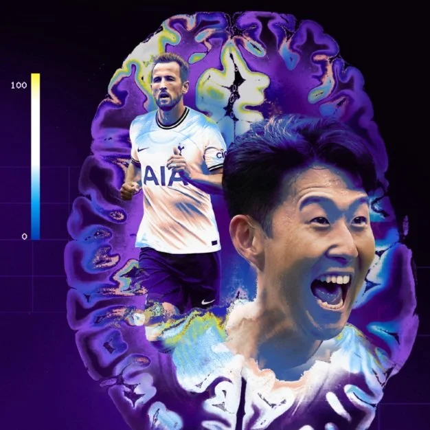 BT Sport | Believe It? Now See It