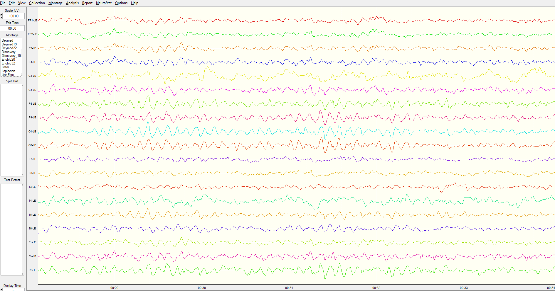 Electrical Neuroimaging