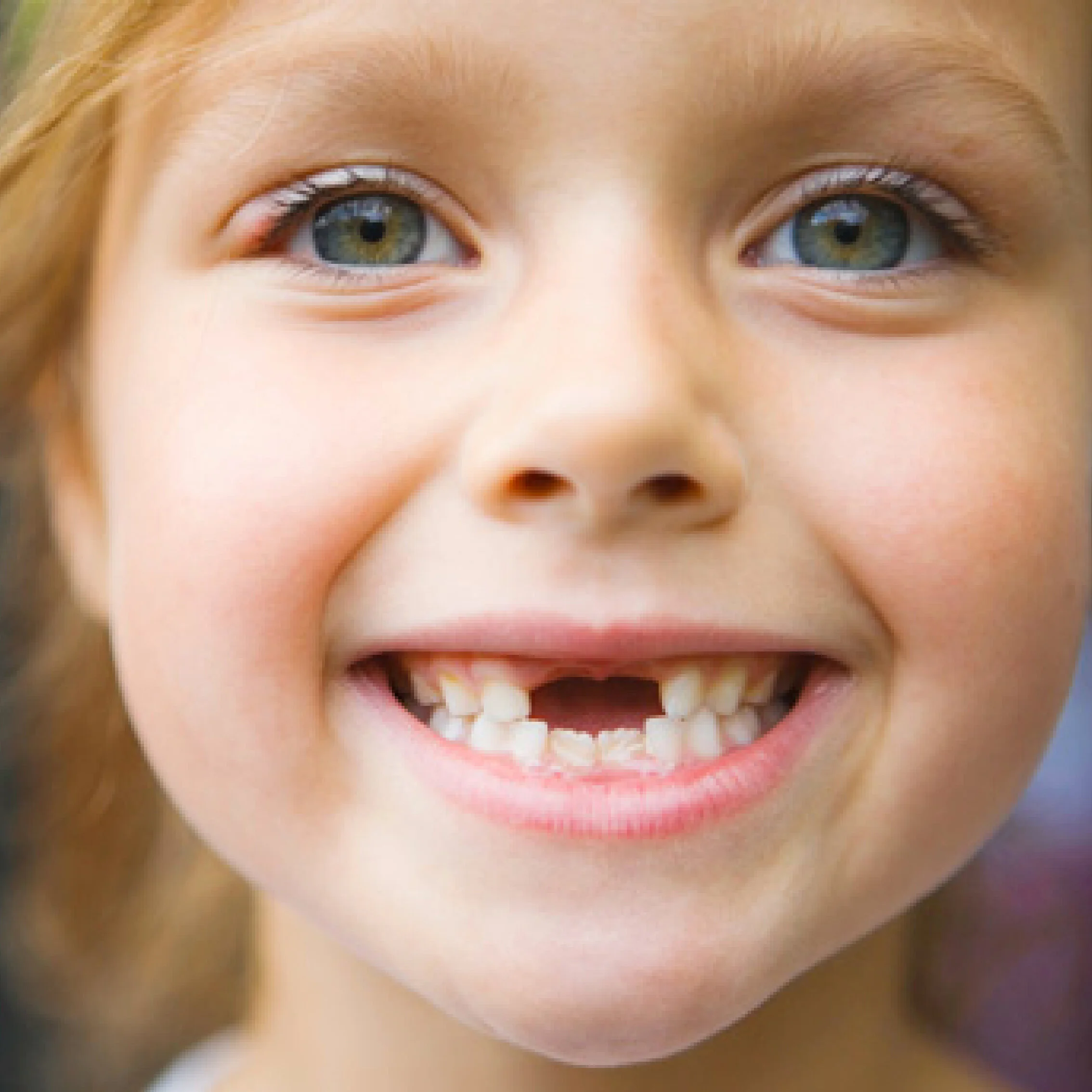 Когда выпадает 4 зуб снизу у ребенка. Прорезался верхний боковой резец. Молочные зубы в 5 лет. Маленький ребенок с зубами. Молочные зубы в 5 лет.