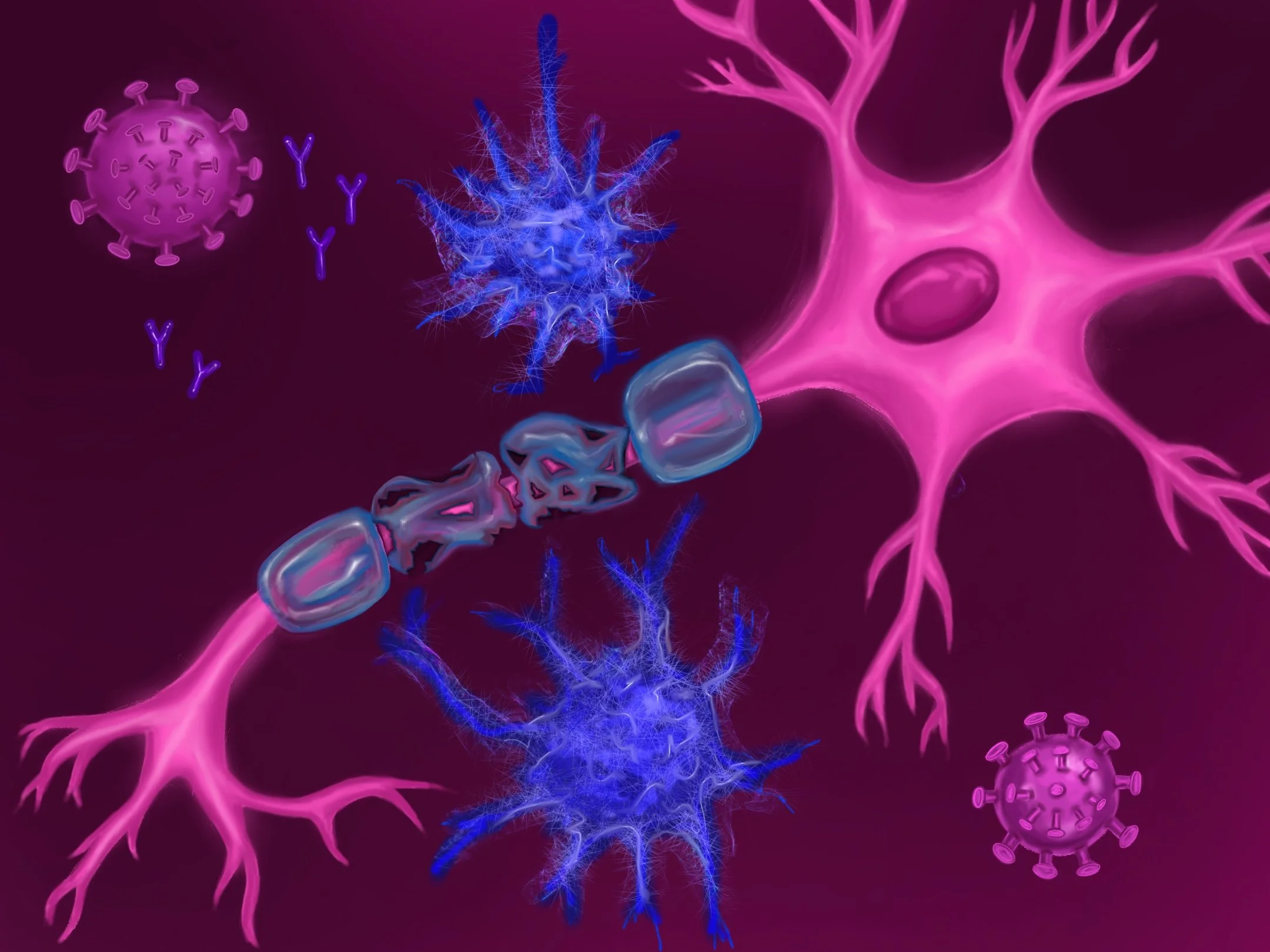 Gene Therapy in Neurodegenerative Diseases: A Path Toward Treating Multiple Sclerosis (MS)