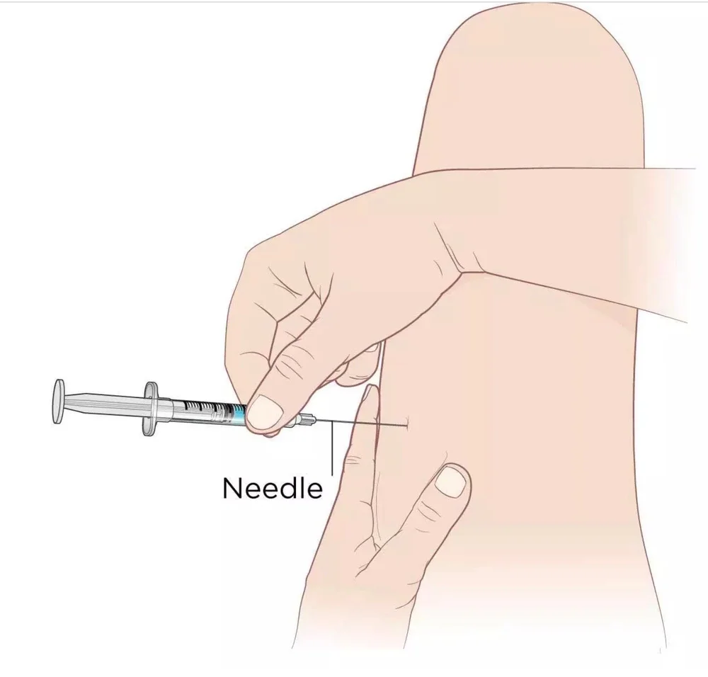 Muscles Contract Injection Intramusclar Injections: 101 — The Proceduralist
