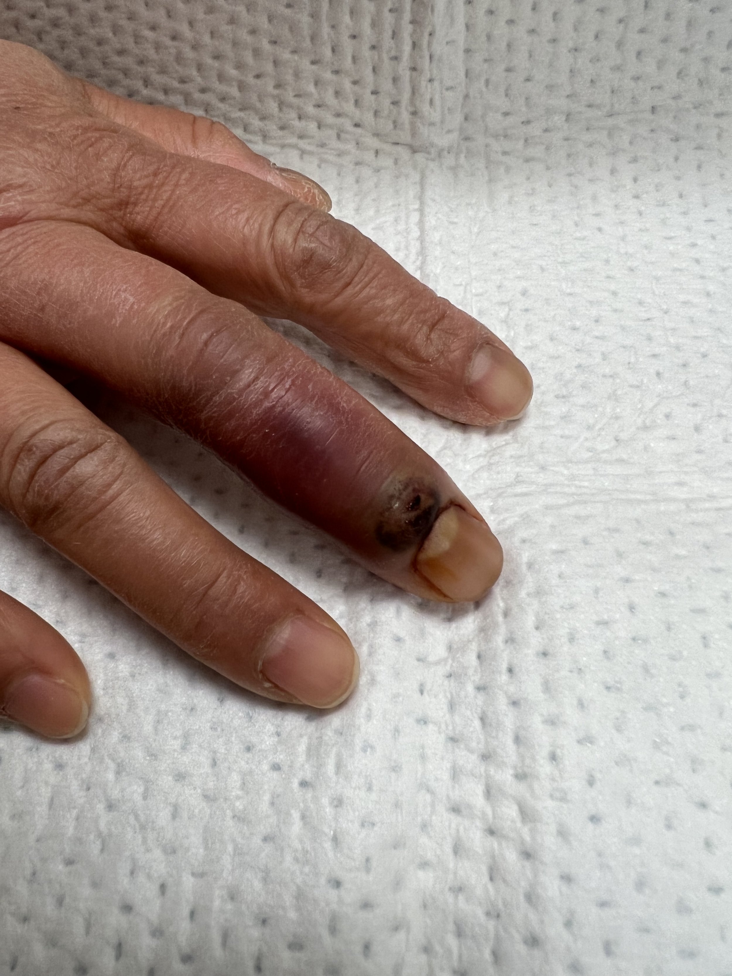 Paronychias are painful infections of the skin around the nails, which... |  TikTok