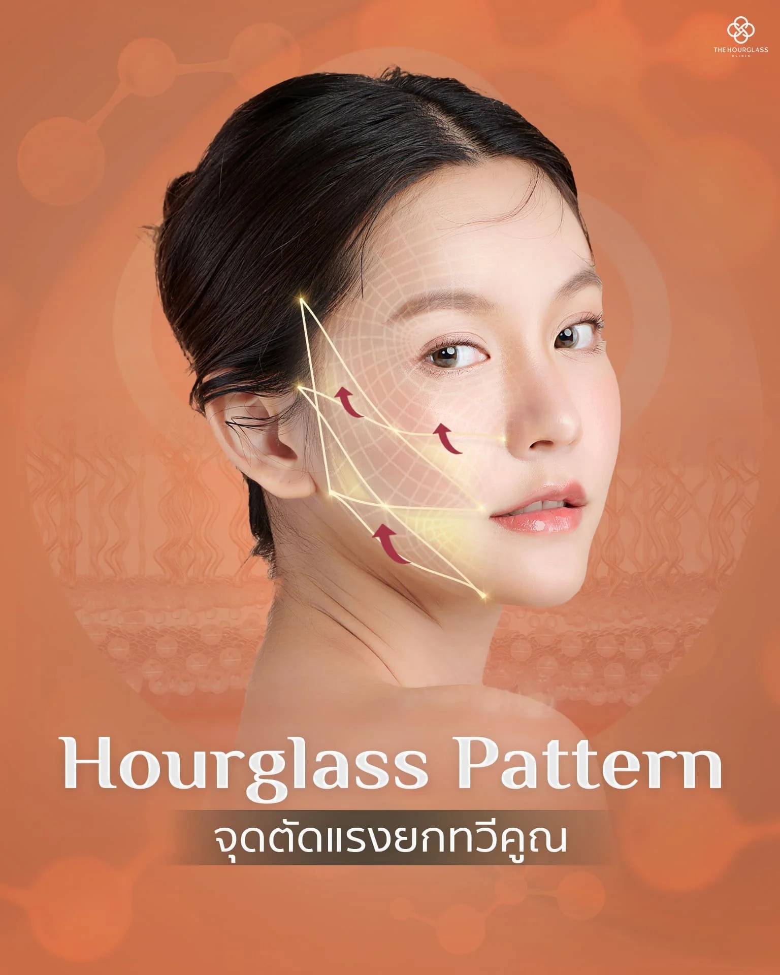 กราฟิกแสดงการไขว้ไหมรูปนาฬิกาทราย (Hourglass Pattern) เพื่อสร้างจุดตัดแรงยก (Intersection Force) ช่วยกระจายแรงดึงทั่วใบหน้า ให้ผลลัพธ์การยกกระชับแบบ Whole Face Lift ที่ดูเป็นธรรมชาติ ไม่ตึงแข็ง