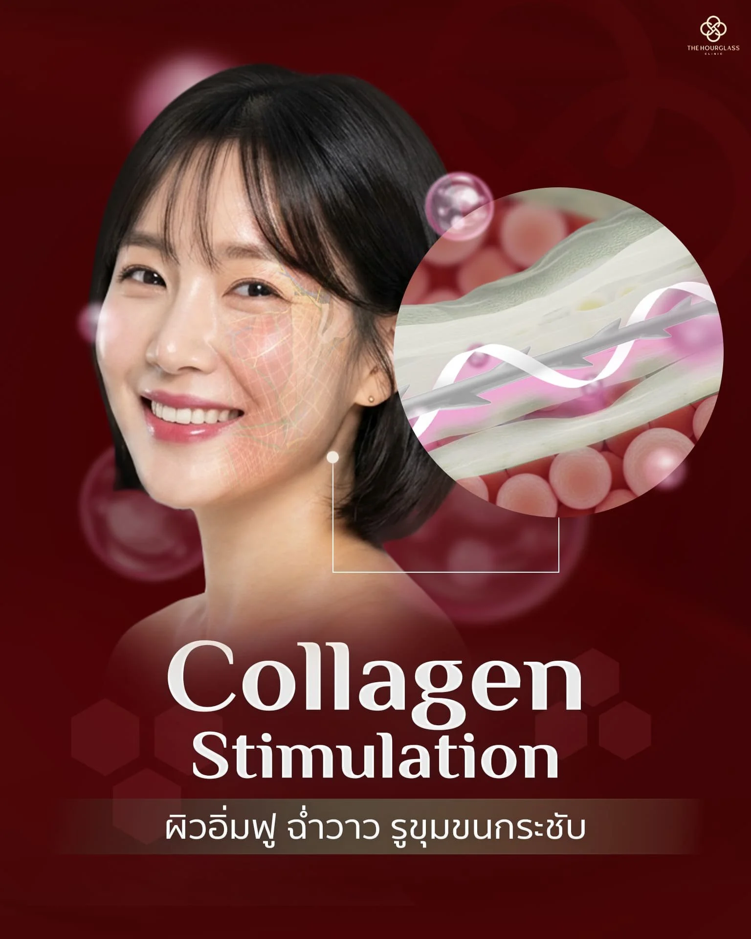 ภาพจำลองการกระตุ้นคอลลาเจนและอีลาสตินจากไหม PCL ช่วยให้ผิวแน่น อิ่มฟู และฉ่ำวาวระดับคริสตัลหลังร้อยไหม Crystal Lift