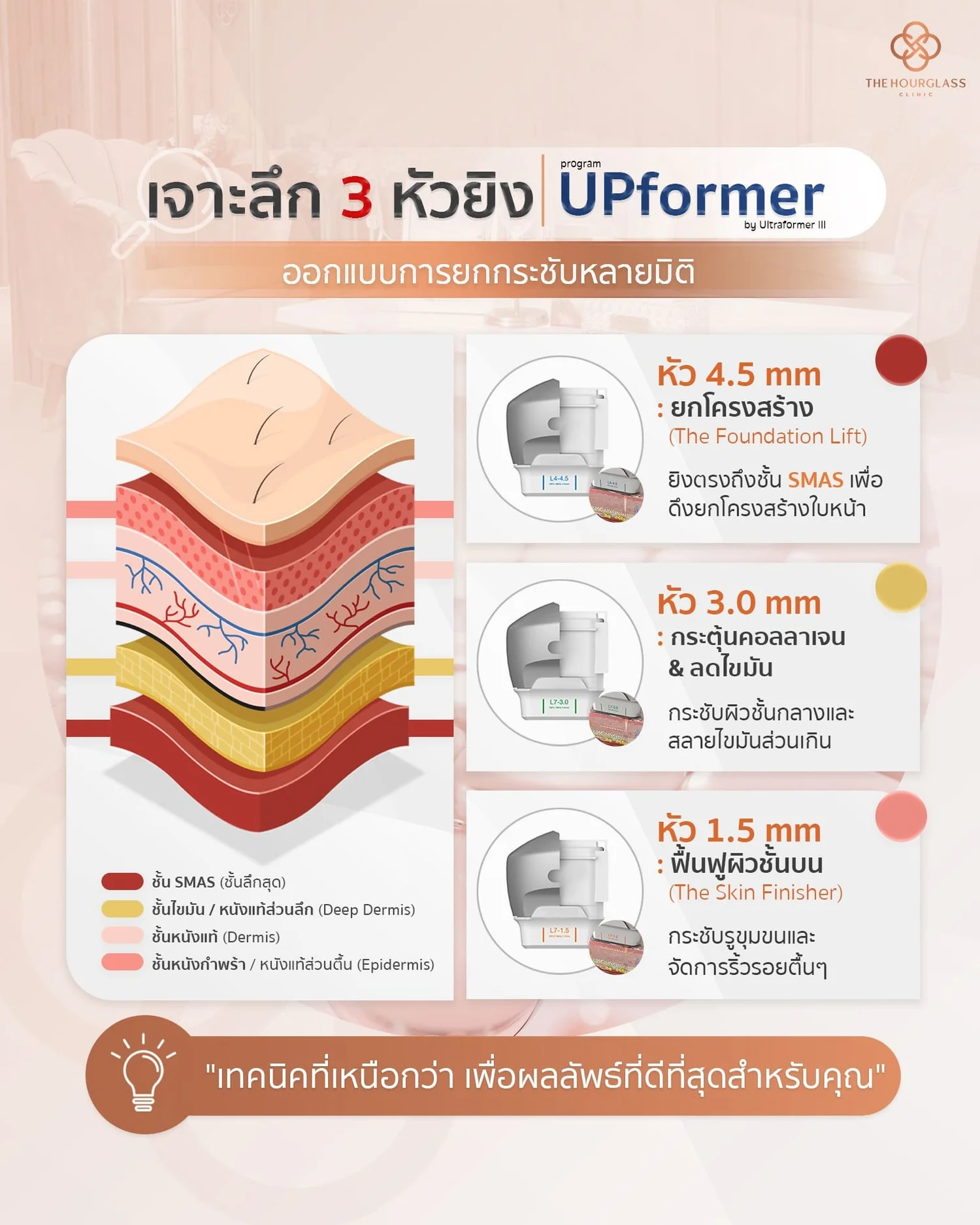 Ultraformer III คืออะไร? รู้จักเทคนิค THC Vector | The Hourglass Clinic ...