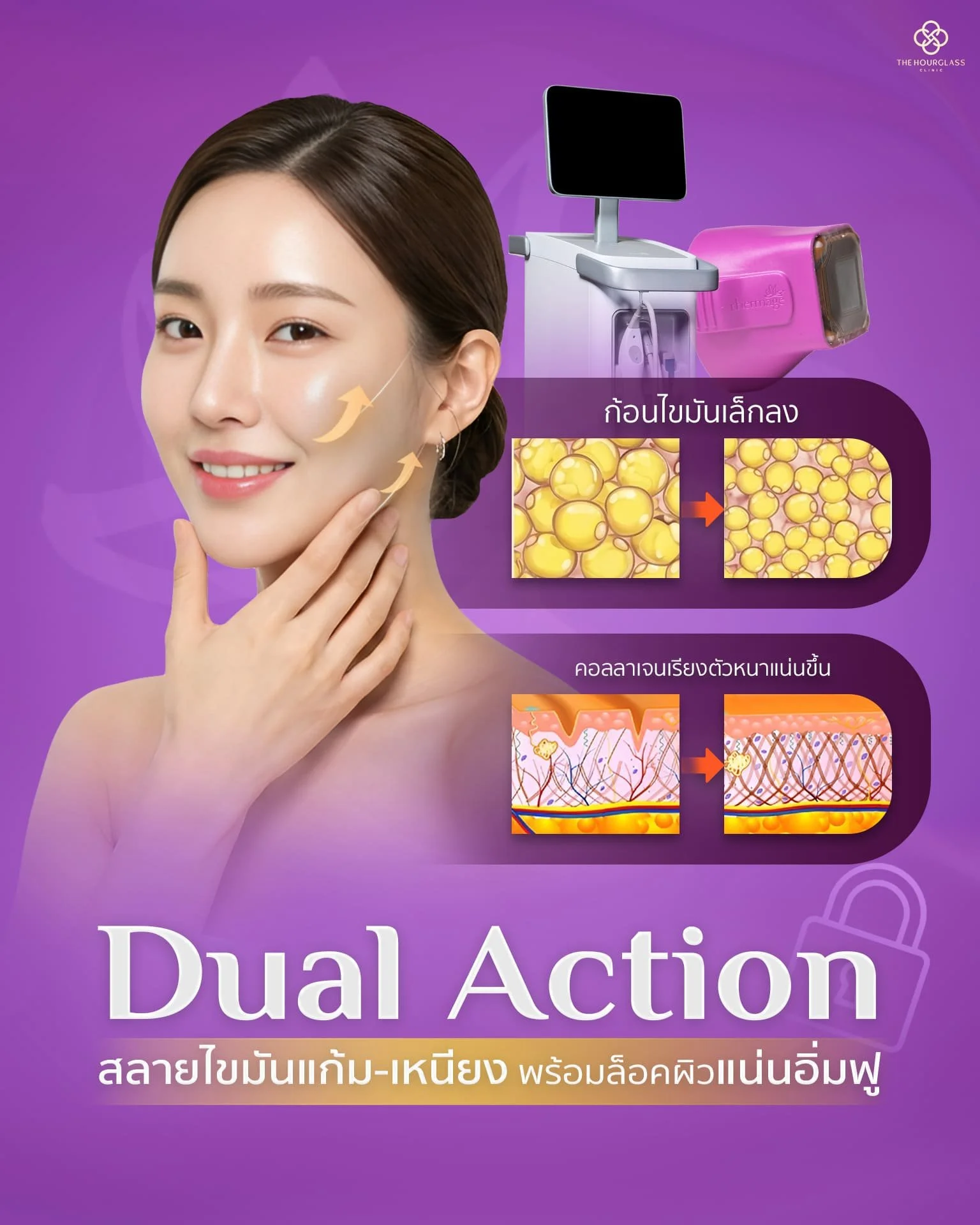 เจาะลึก 3 จุดเด่น Thermage FLX ที่ The Hourglass Clinic ด้วยเทคโนโลยี AccuREP ปรับพลังงานรายช็อตเพื่อสลายไขมันและยกกระชับผิวหน้าให้แน่นอิ่มฟู เห็นผลยาวนานโดยไม่ต้องผ่าตัดหรือพักฟื้น