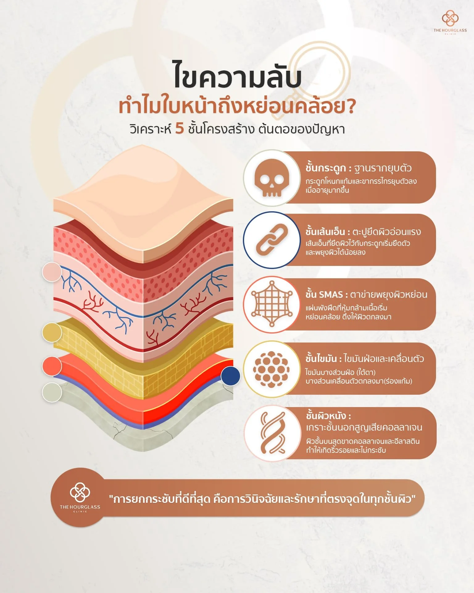 อินโฟกราฟิกอธิบาย 5 ชั้นโครงสร้างใบหน้าที่เป็นสาเหตุของความหย่อนคล้อย จาก The Hourglass Clinic: 1. ชั้นกระดูก (ยุบตัว), 2. ชั้นเส้นเอ็น (อ่อนแรง), 3. ชั้น SMAS (หย่อน), 4. ชั้นไขมัน (เคลื่อนตัว), และ 5. ชั้นผิว (ขาดคอลลาเจน)
