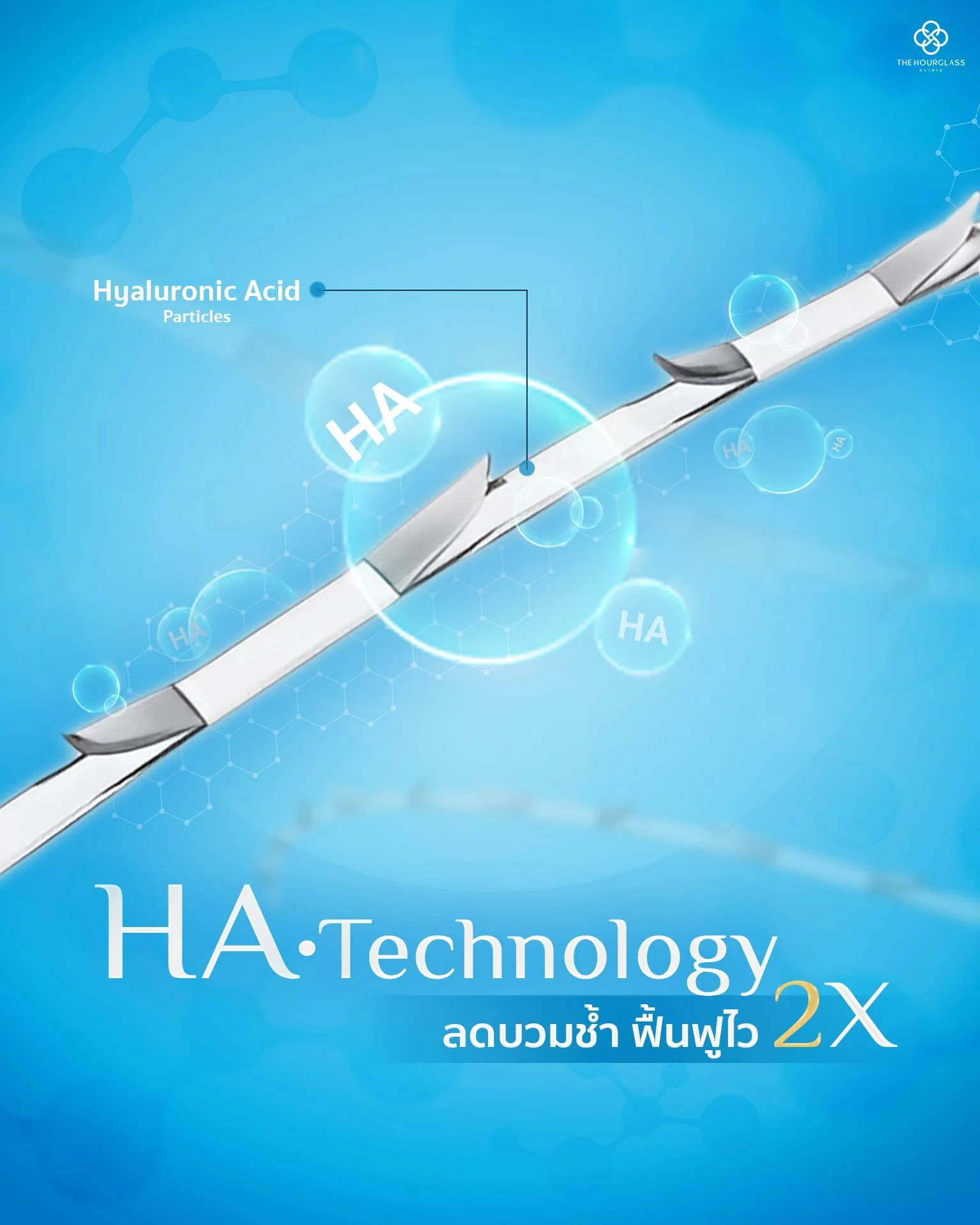 ภาพจำลองนวัตกรรม HA Technology ในไหม APTOS รุ่นใหม่ที่มีส่วนผสมของ Hyaluronic Acid ช่วยลดการอักเสบและอาการบวมช้ำหลังร้อยไหม ทำให้คนไข้ฟื้นฟูผิวได้ไวขึ้น 2 เท่า