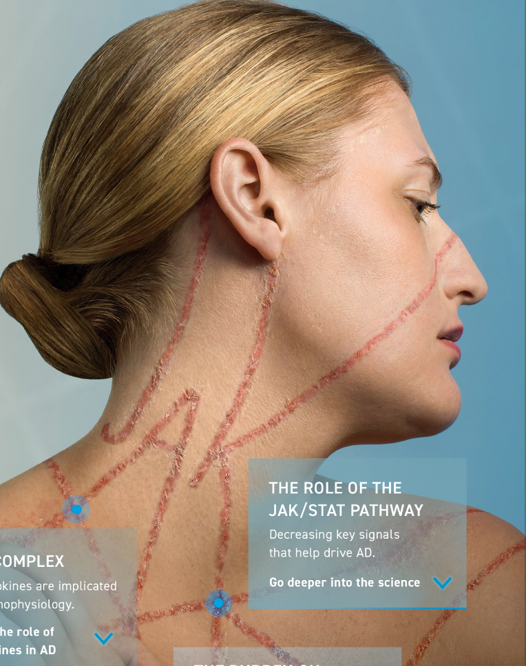 Pfizer Abrocitinib Unbranded Website
Concept + Design + Art Direction Lead