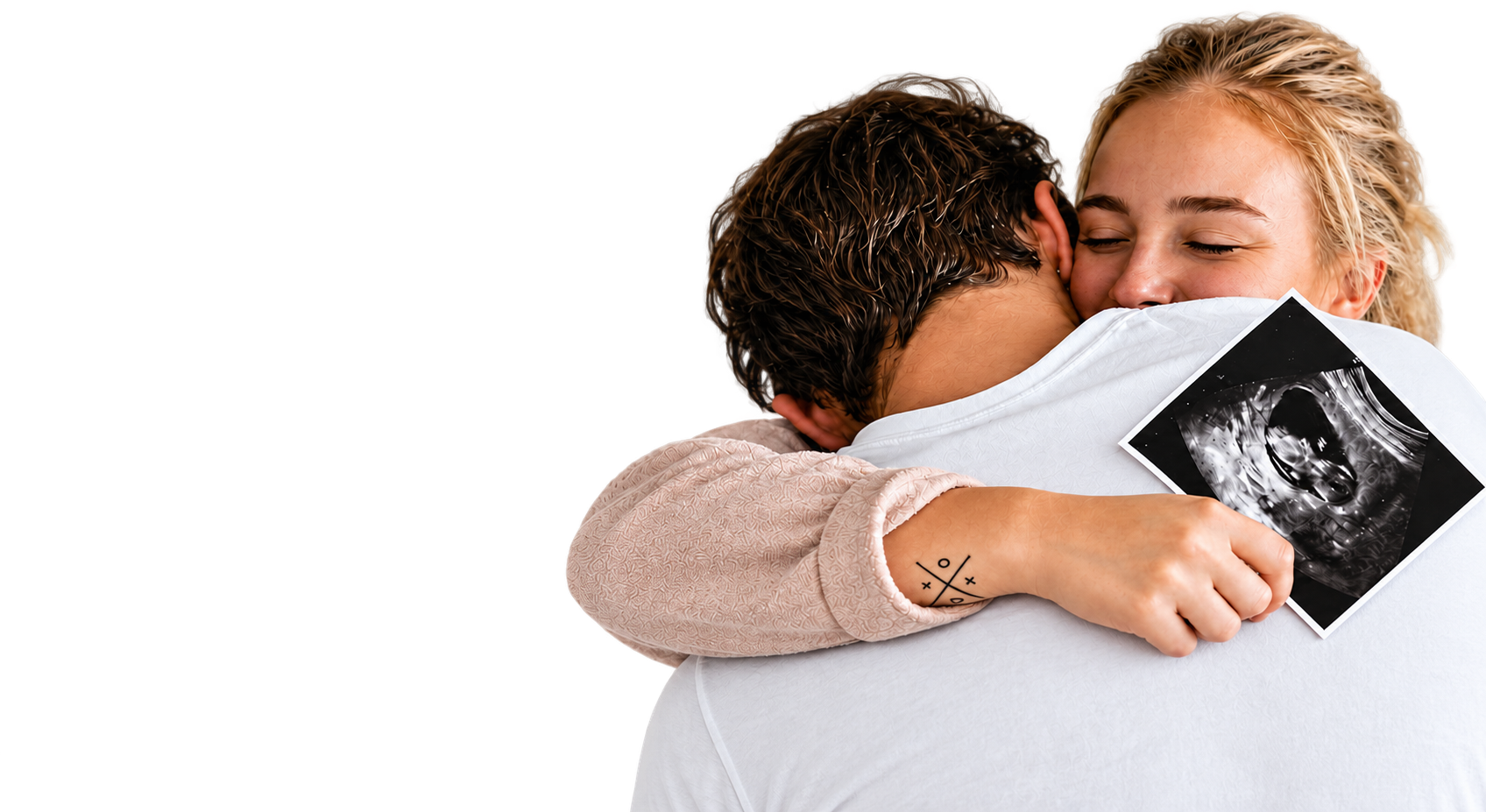 Couple embracing after pregnancy with the help of fertility acupuncture