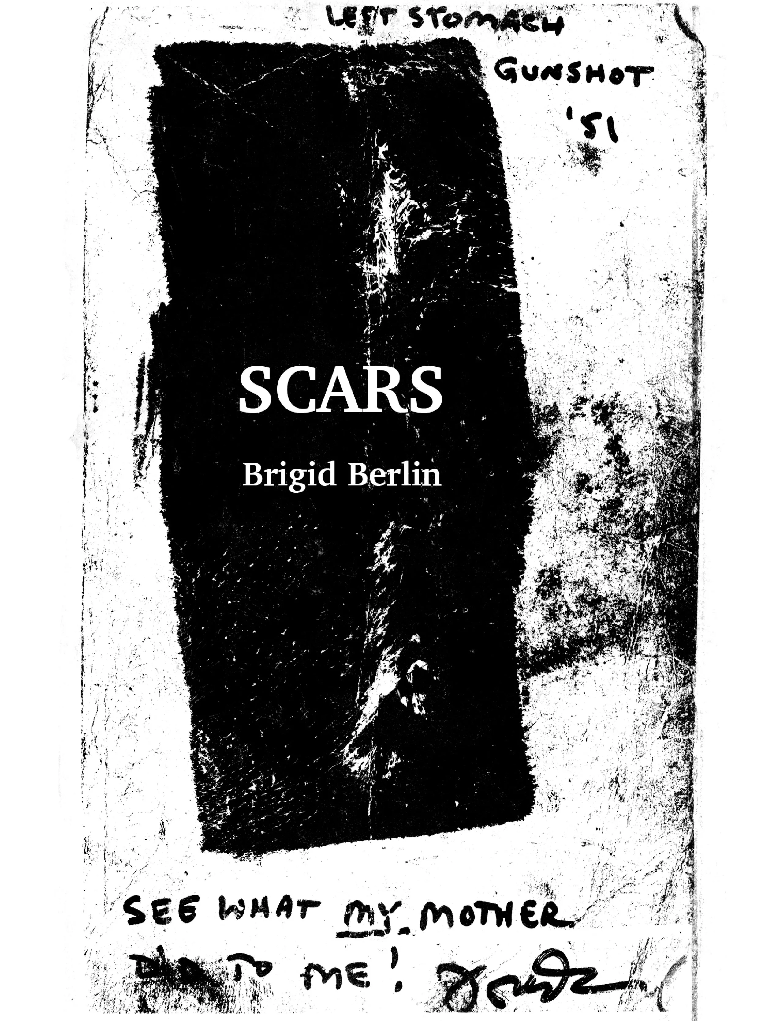 Scars by Brigid Berlin