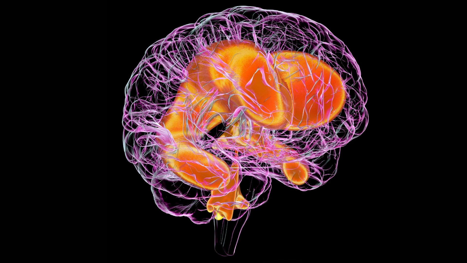 Hidrocefalia en adultos: una condición que muchas veces pasa desapercibida