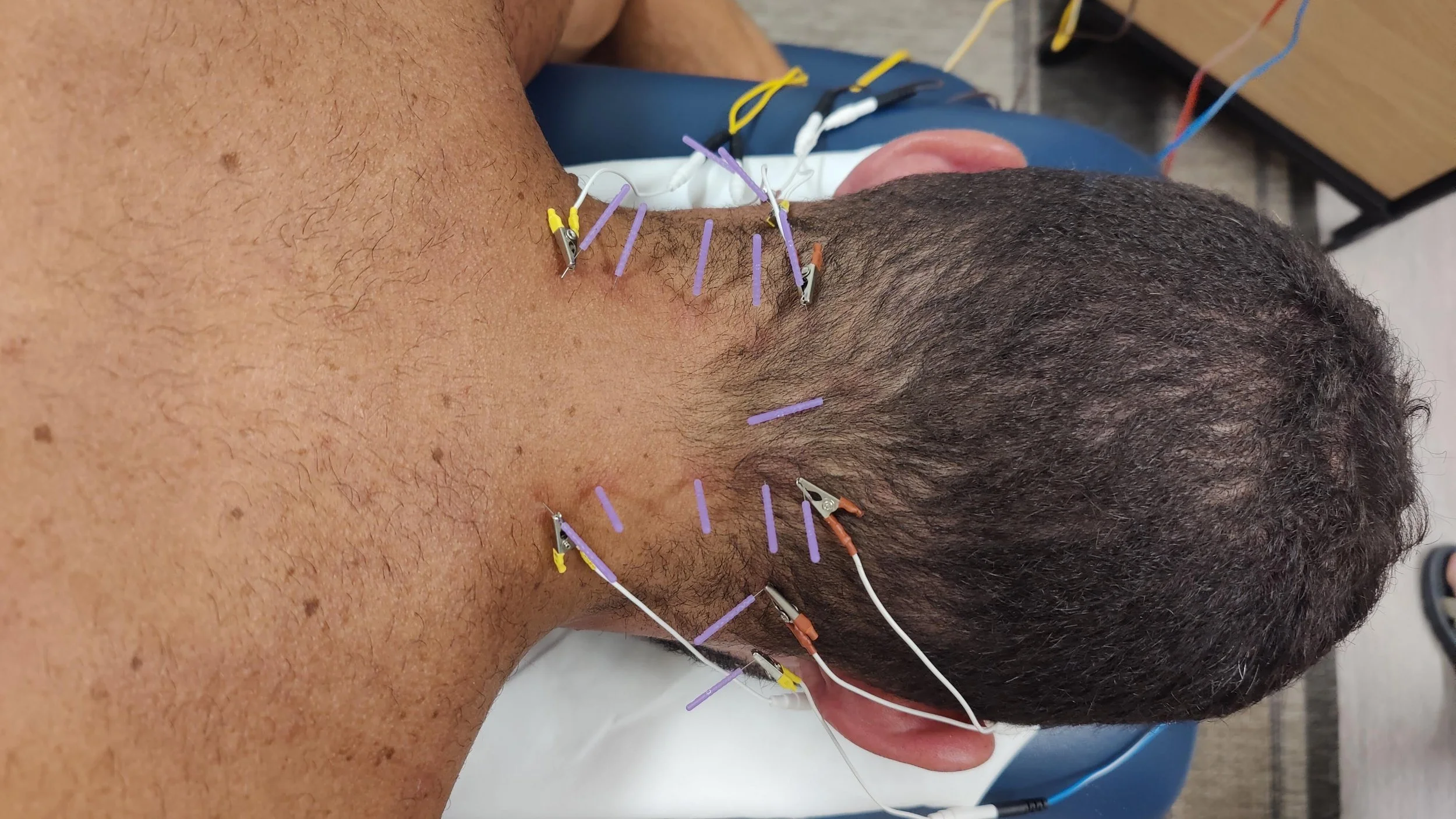 physical therapy for pain management