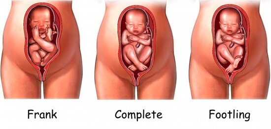 what is the position of the baby at 25 weeks