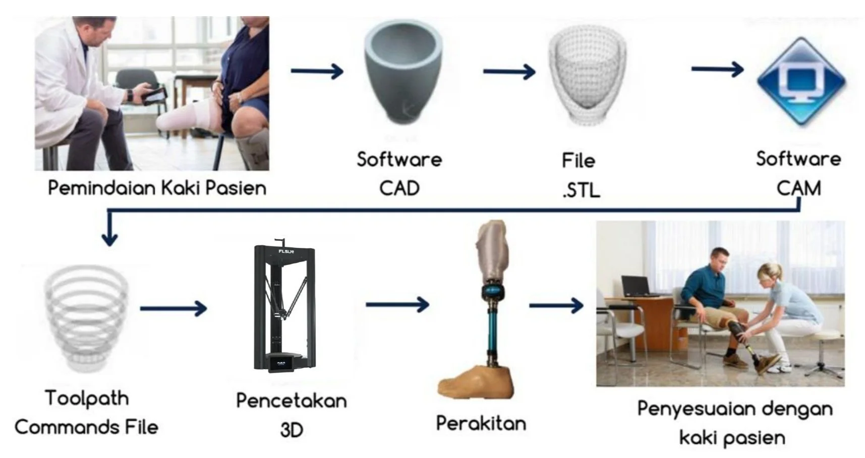 Microprocessor Prosthetis Prosthetic Leg — Teknomedika