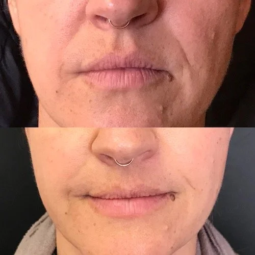 Mei Zen Mouth Area.JPG