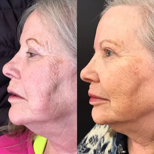 Mei Zen Side View.JPG