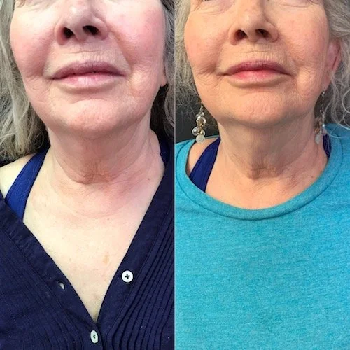 Mei Zen Neck Front.JPG