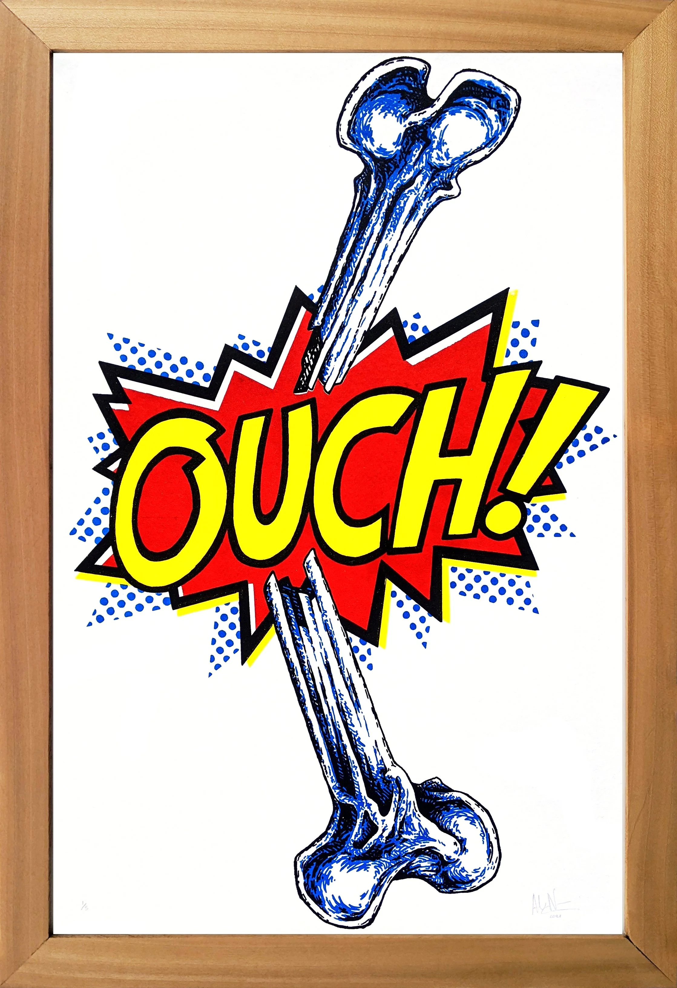 OUCH!Framed.jpg