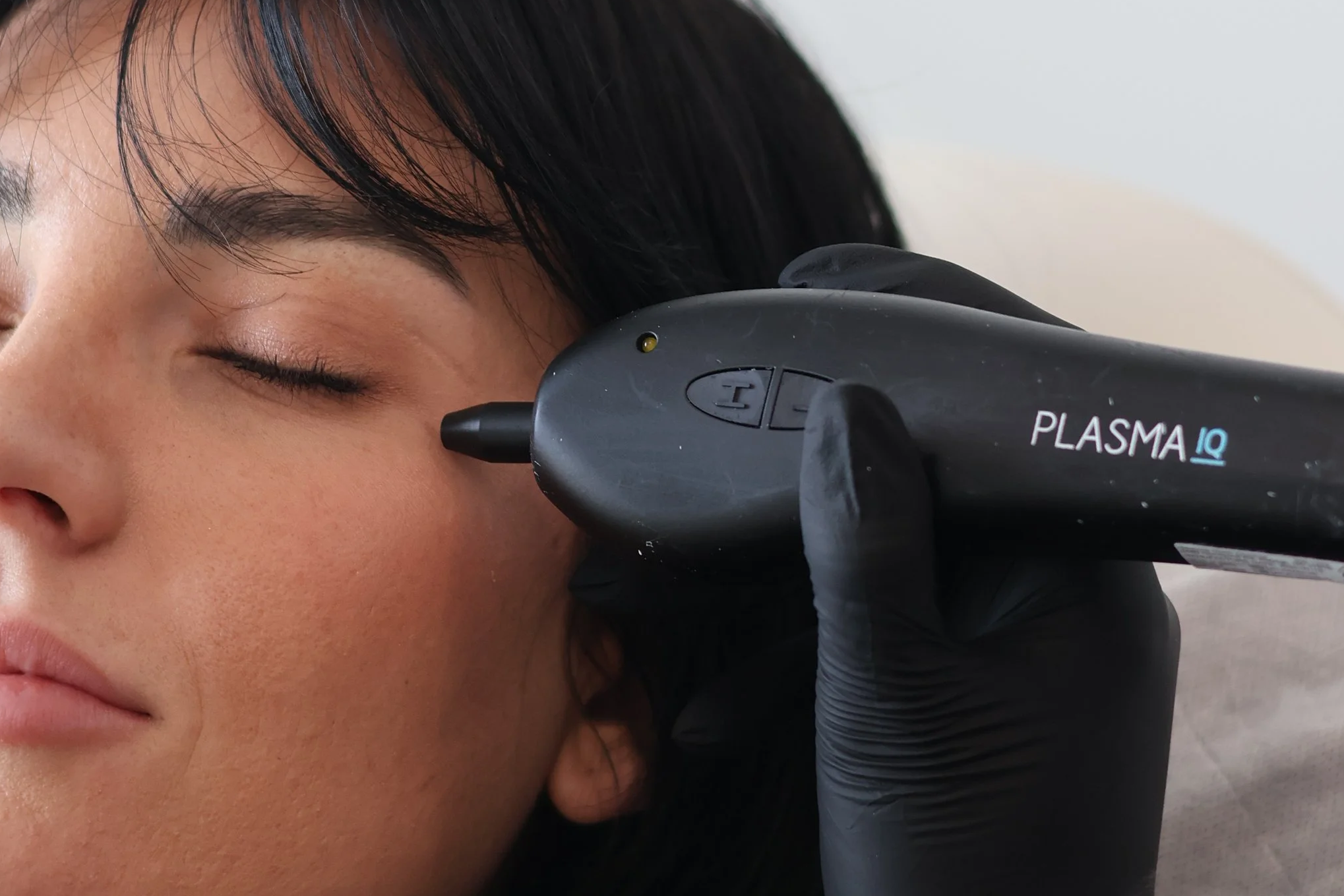 Close-up of a person's neck and lower face with dotted surgical markings, likely preoperative markings for a cosmetic or medical procedure.