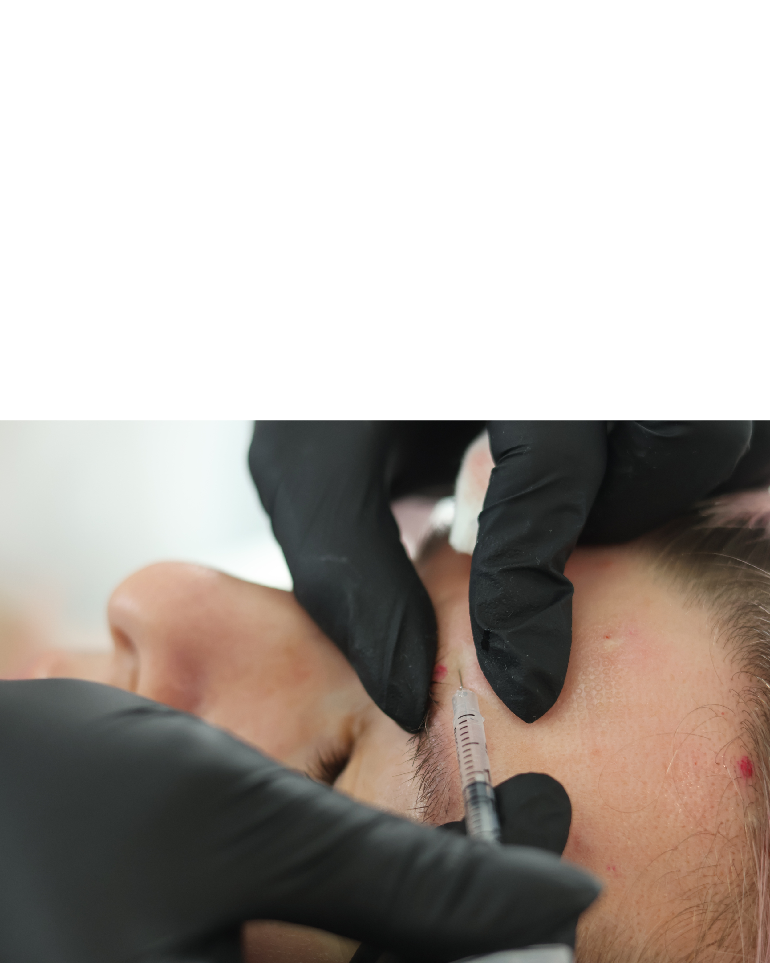 Close-up of a woman's face in black and white, showing her eyes, eyebrows, and part of her forehead with freckles.