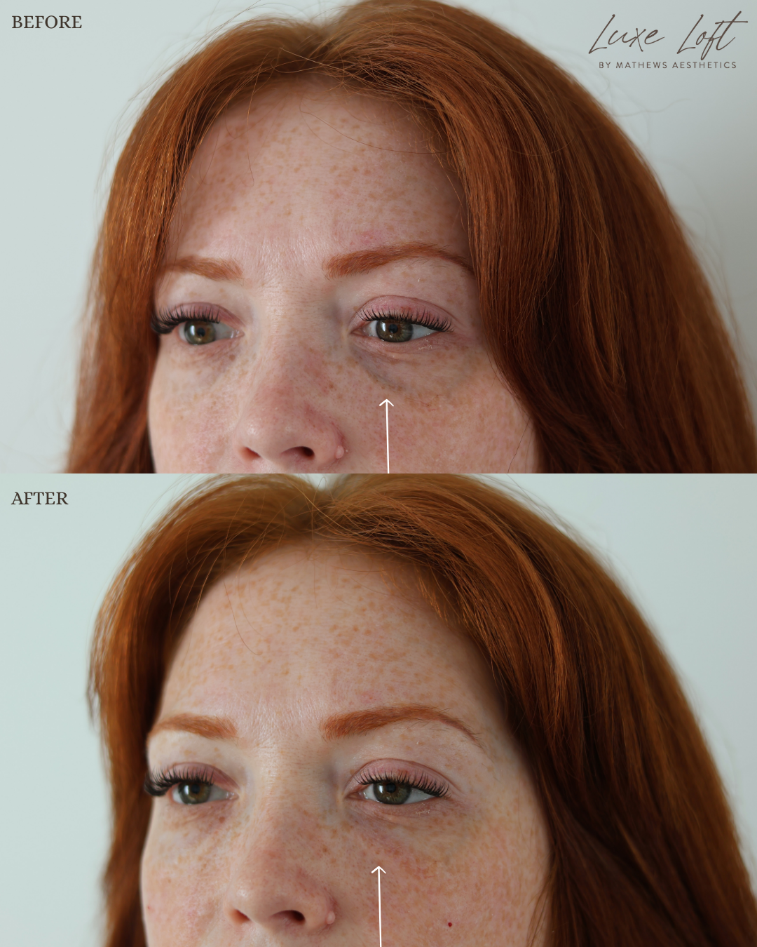 SHANNA WILSON DERMA PRP (1).png
