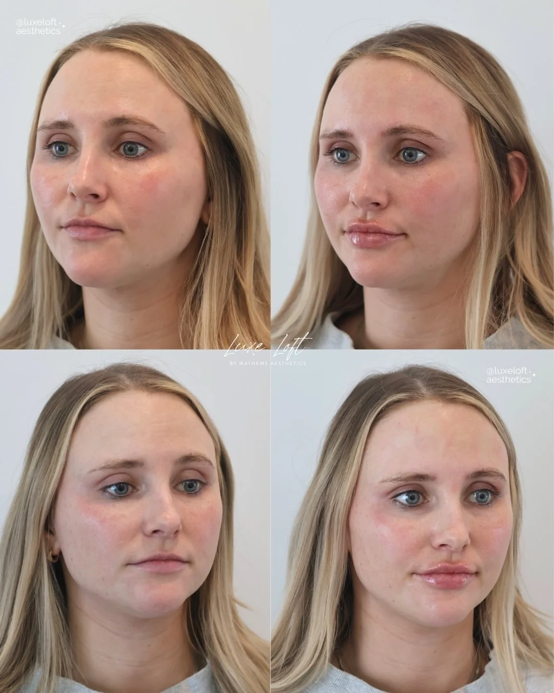 A four-panel collage showing before and after images of a woman's face. The top left and bottom left images depict her with natural, makeup-free skin, while the top right and bottom right images show her with makeup, including glossy lips and enhance