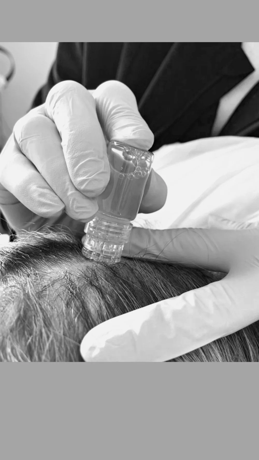 Injectables Look INJECTABLES | Enhance Your Look — Luxe Loft