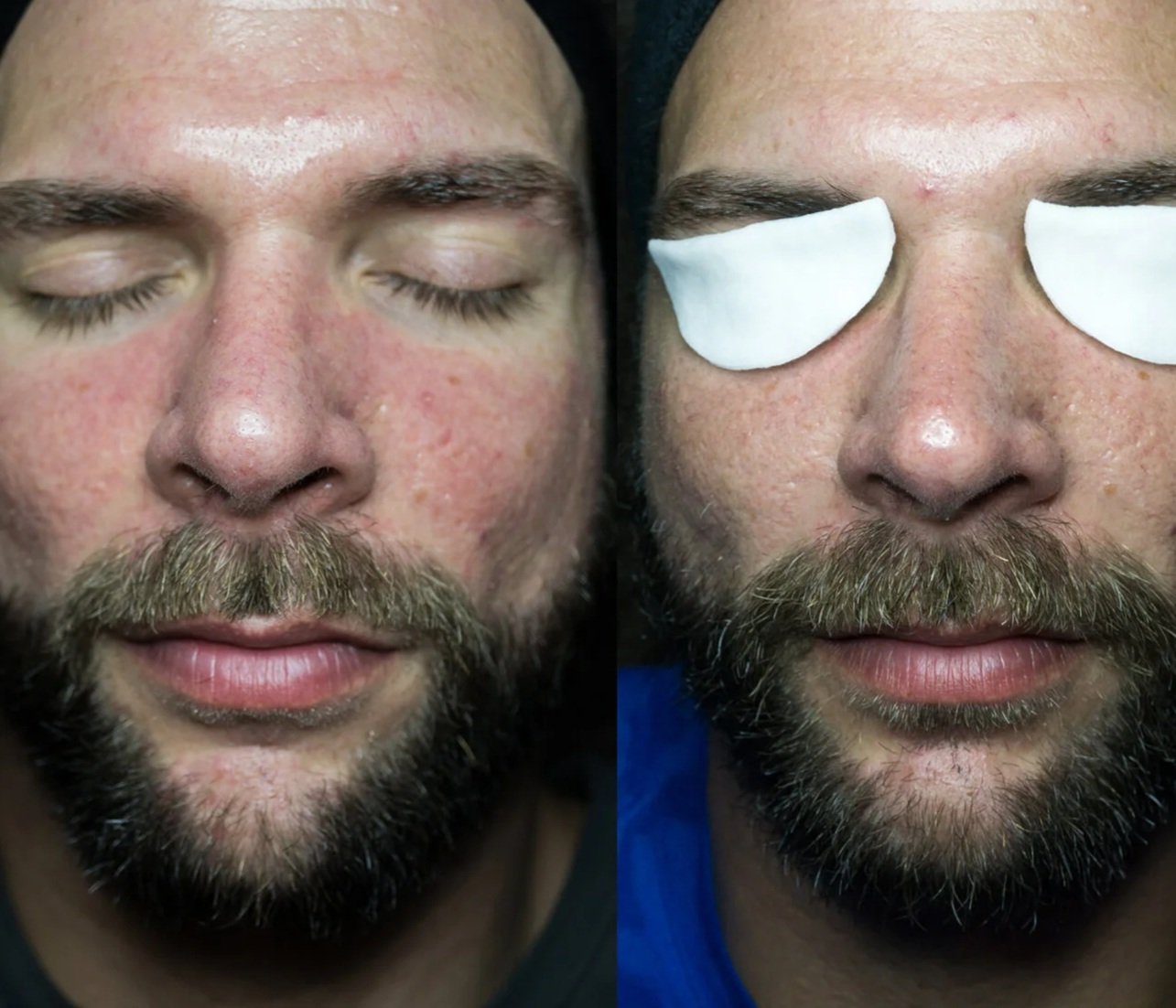 Neck Pain Relief, Migraine Massage | Fishers, IN