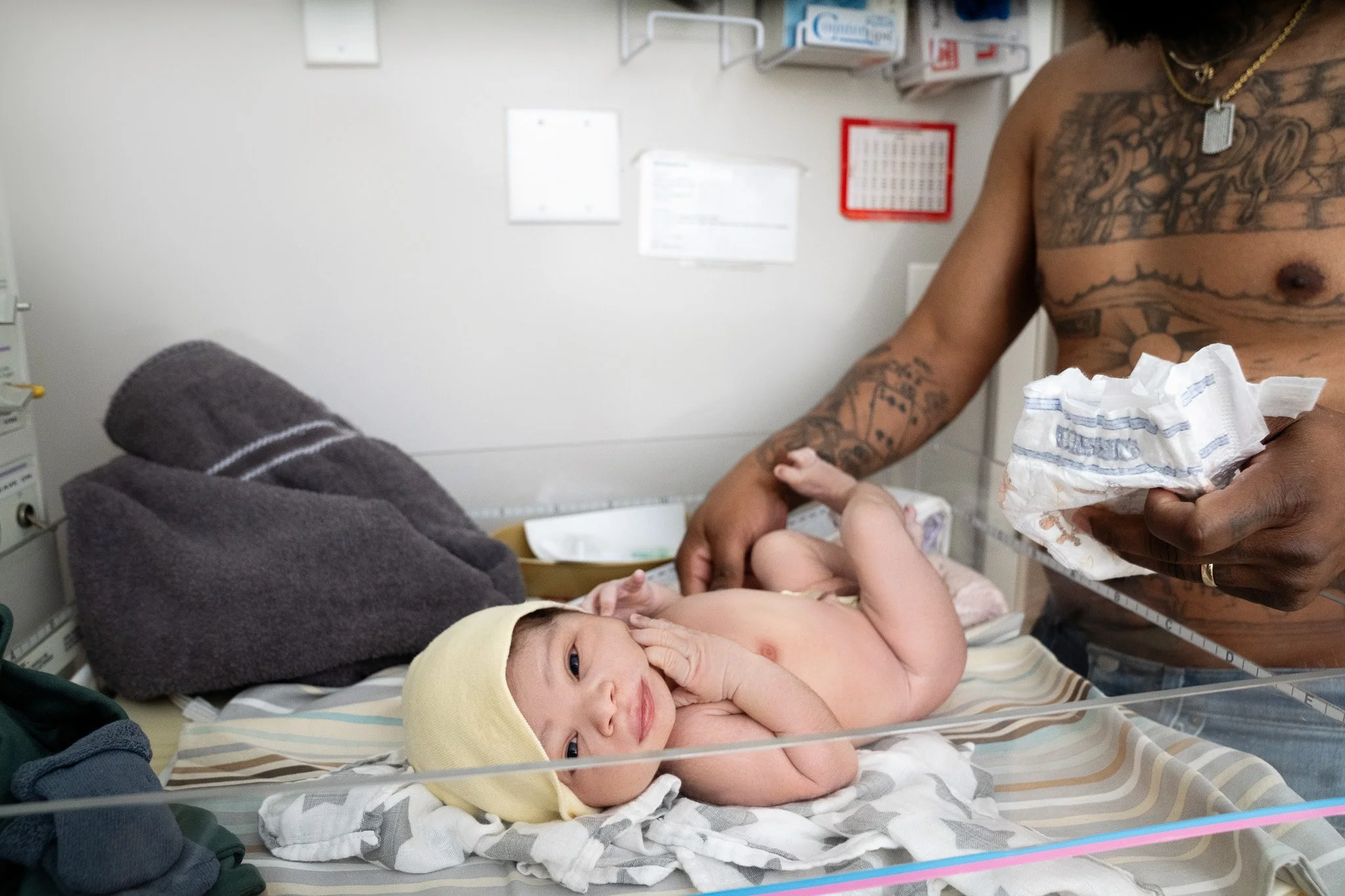 Do I Need a Doula If I'm Getting an Epidural?