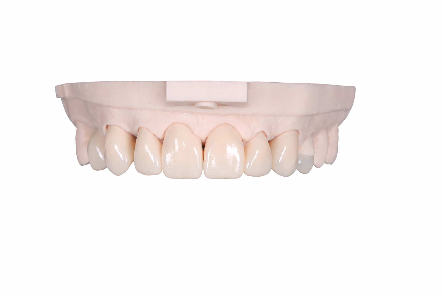 Dental Veneers Queensland Prosthodontics Brisbane Prosthodontics