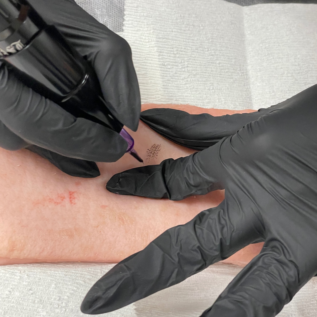 A person receiving a microblading eyebrow tattoo procedure while lying down, with multiple small ink marks on their eyebrow area, wearing black gloves, with a grey towel underneath.