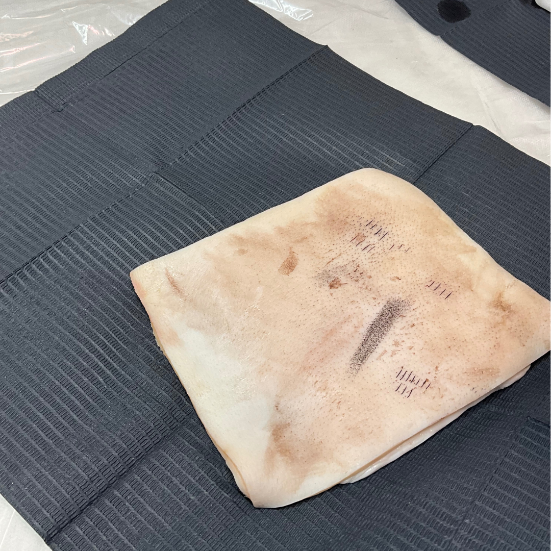 A skin graft with printed markings resting on a black textured surface.