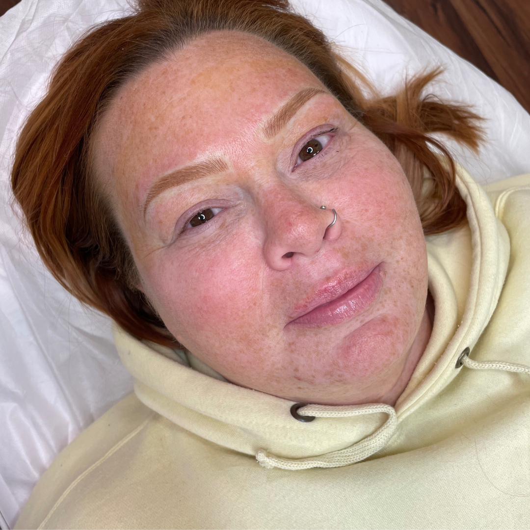 before and after picture of combo brows which is a combination of hair strokes and shading