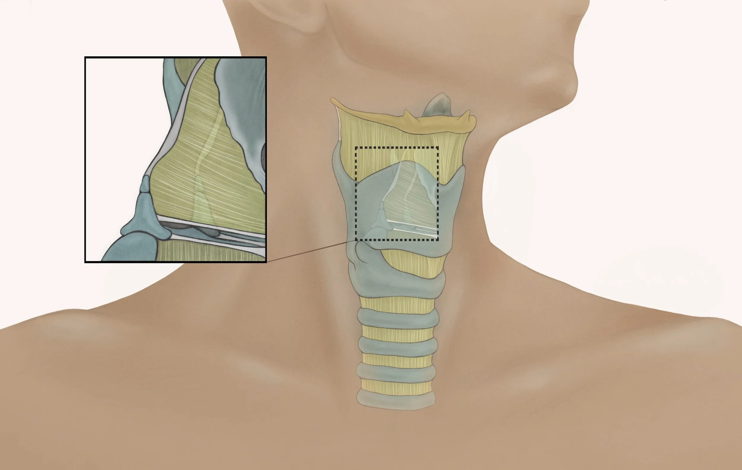 Medical Illustration
