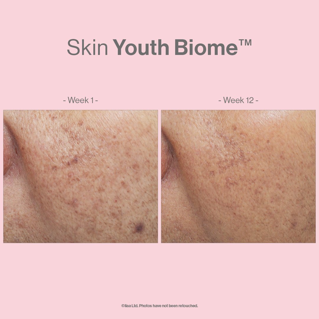 Advanced-Nutrition-Programme-Case-Study-Results_Skin-Youth-Biome-Social-Media-Cheek-Comparison.jpg