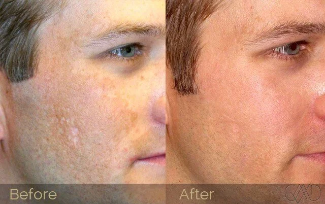 1_Mmh0PvRbosxnQCvxtb69fg.jpg