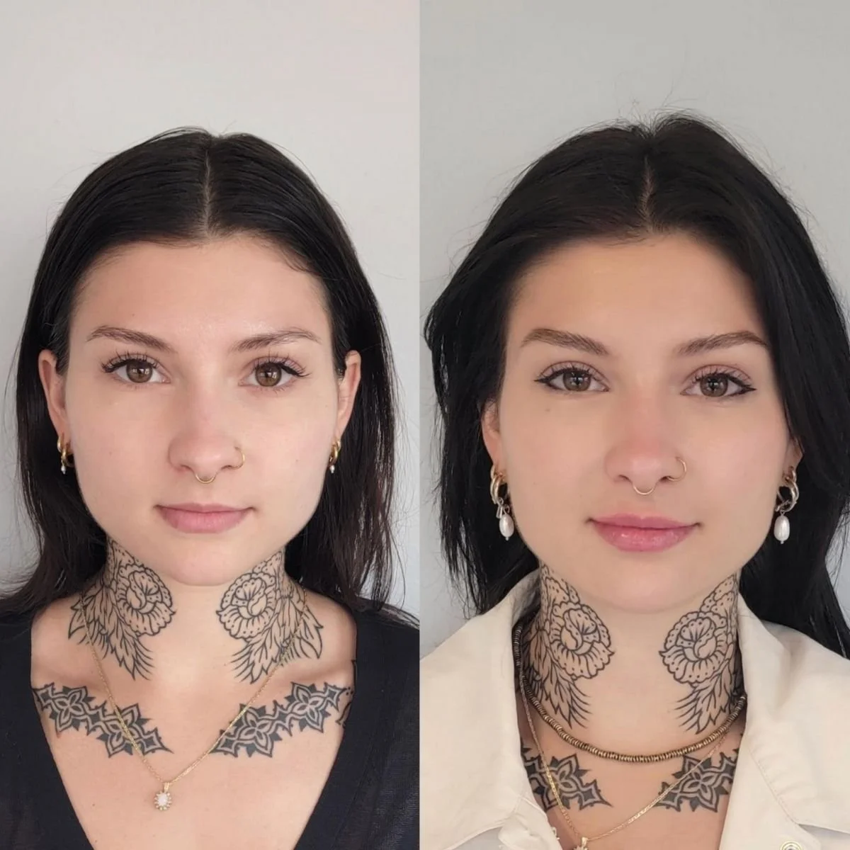 Facial Balancing in Denver (1200 x 900 px)-2.jpg