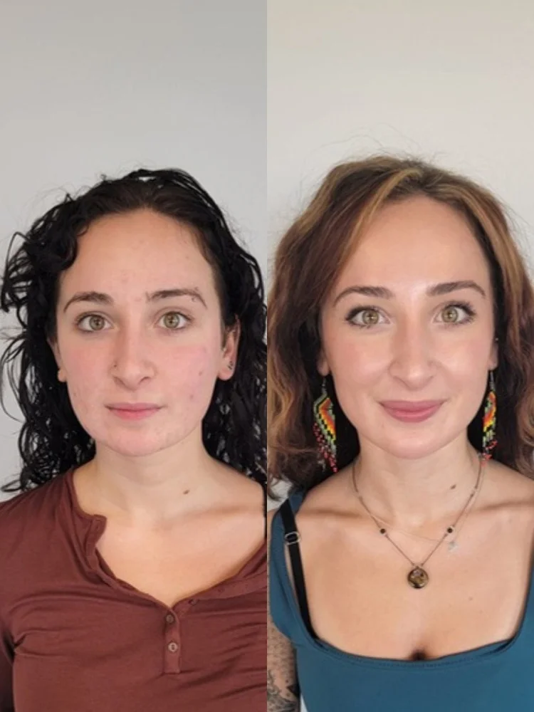 Before and after microneedling at Cheeky Denver