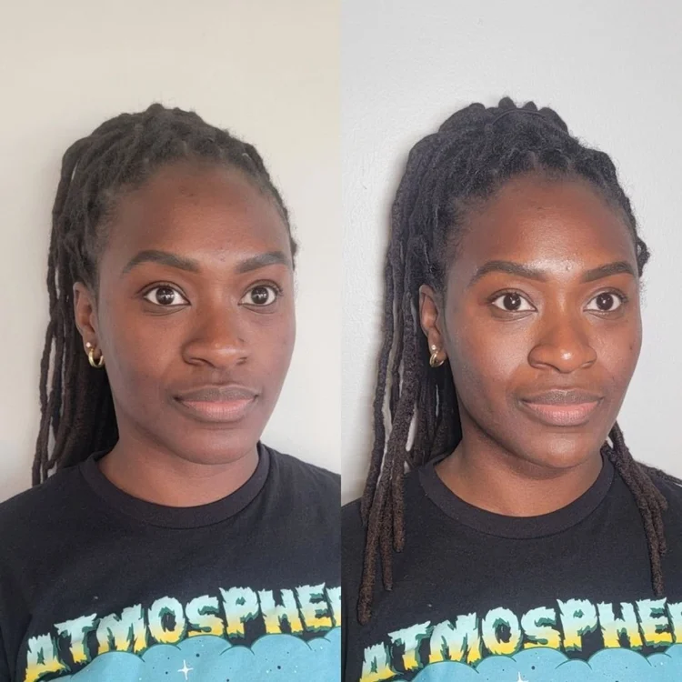 Before and after facial balancing at Cheeky Denver, patient six